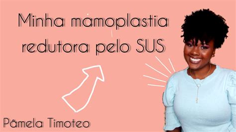 cirurgia períneo pelo sus|Como conseguir Mamoplastia Redutora pelo SUS